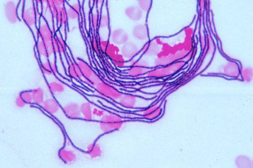 Gram Stain Bacillus anthracis